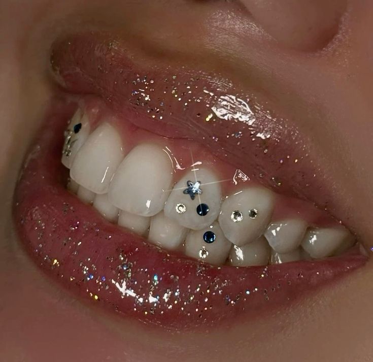 Tooth Gems