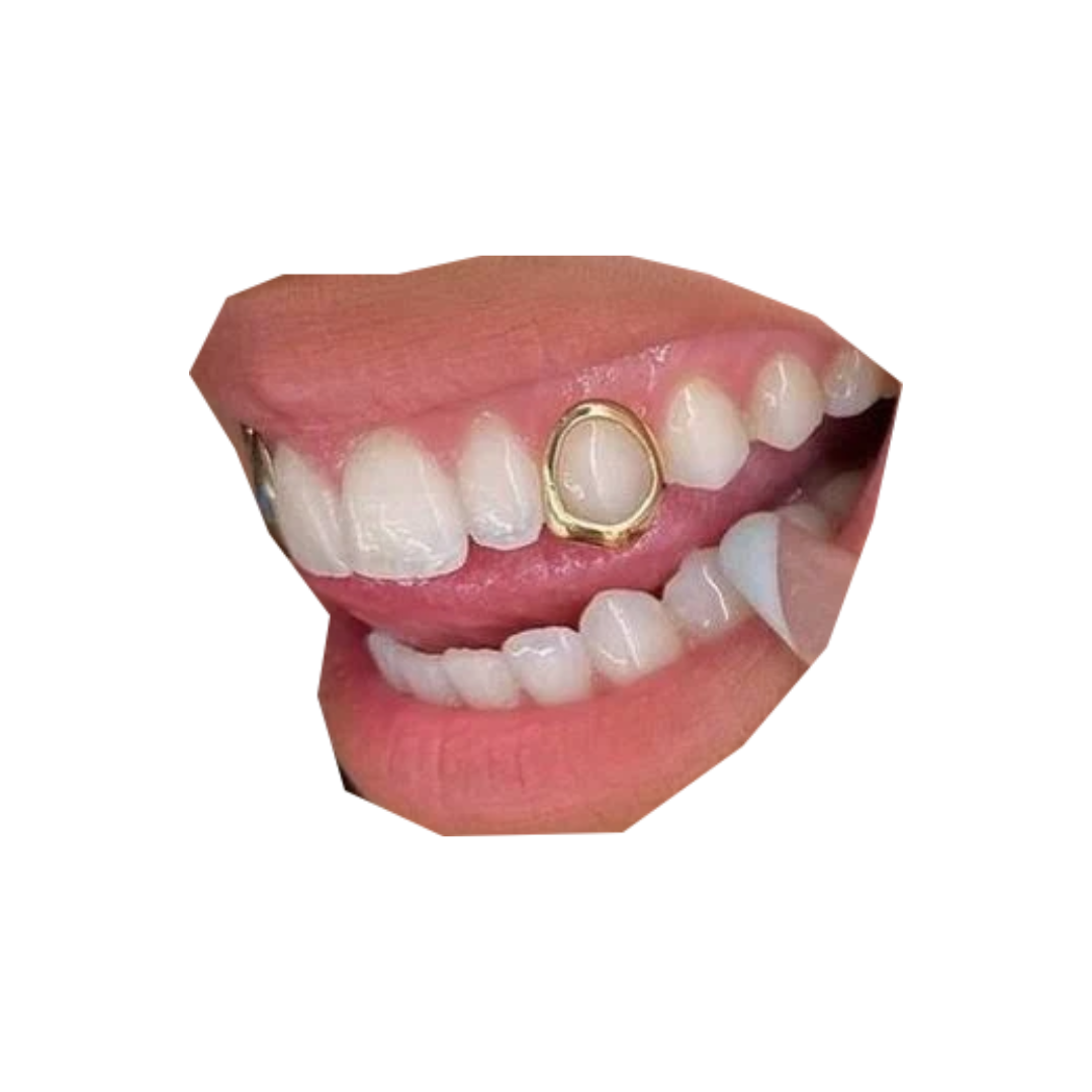 Single Tooth with Protective Layer Added