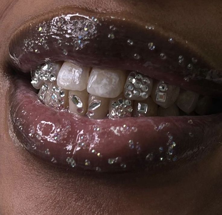 Tooth Gems
