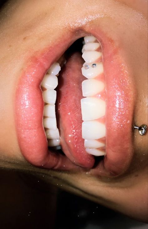 Tooth Gems
