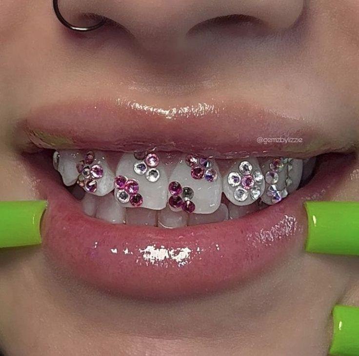 Tooth Gems