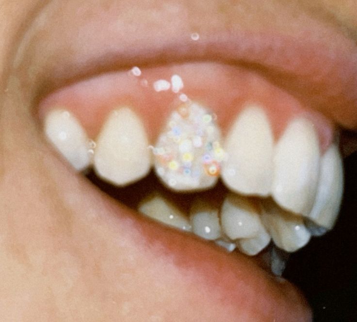 Tooth Gems